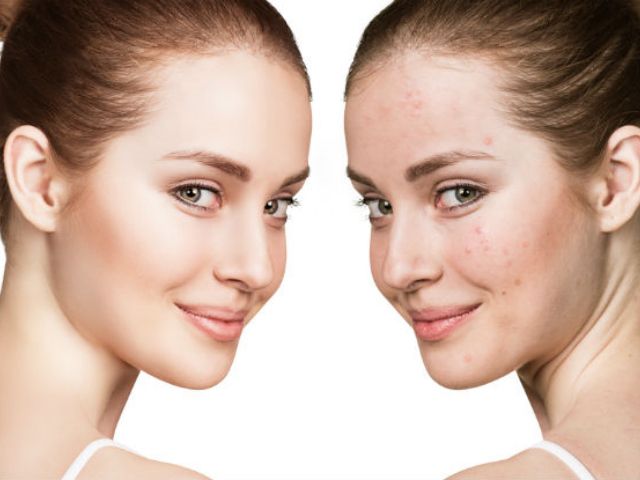 美容皮膚科に通うメリットと選び方のポイント